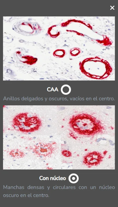 El panel de Ejemplos con imágenes de referencia de CAA y placas con núcleo.