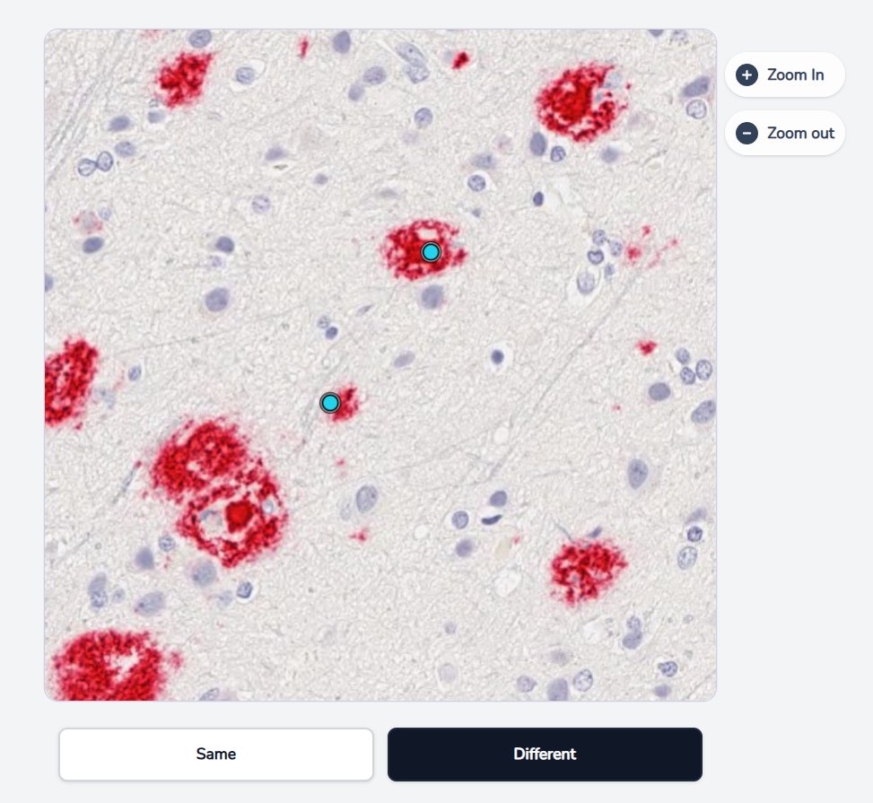 The match task: a brain tissue image with two cyan dots, and Same / Different buttons below.